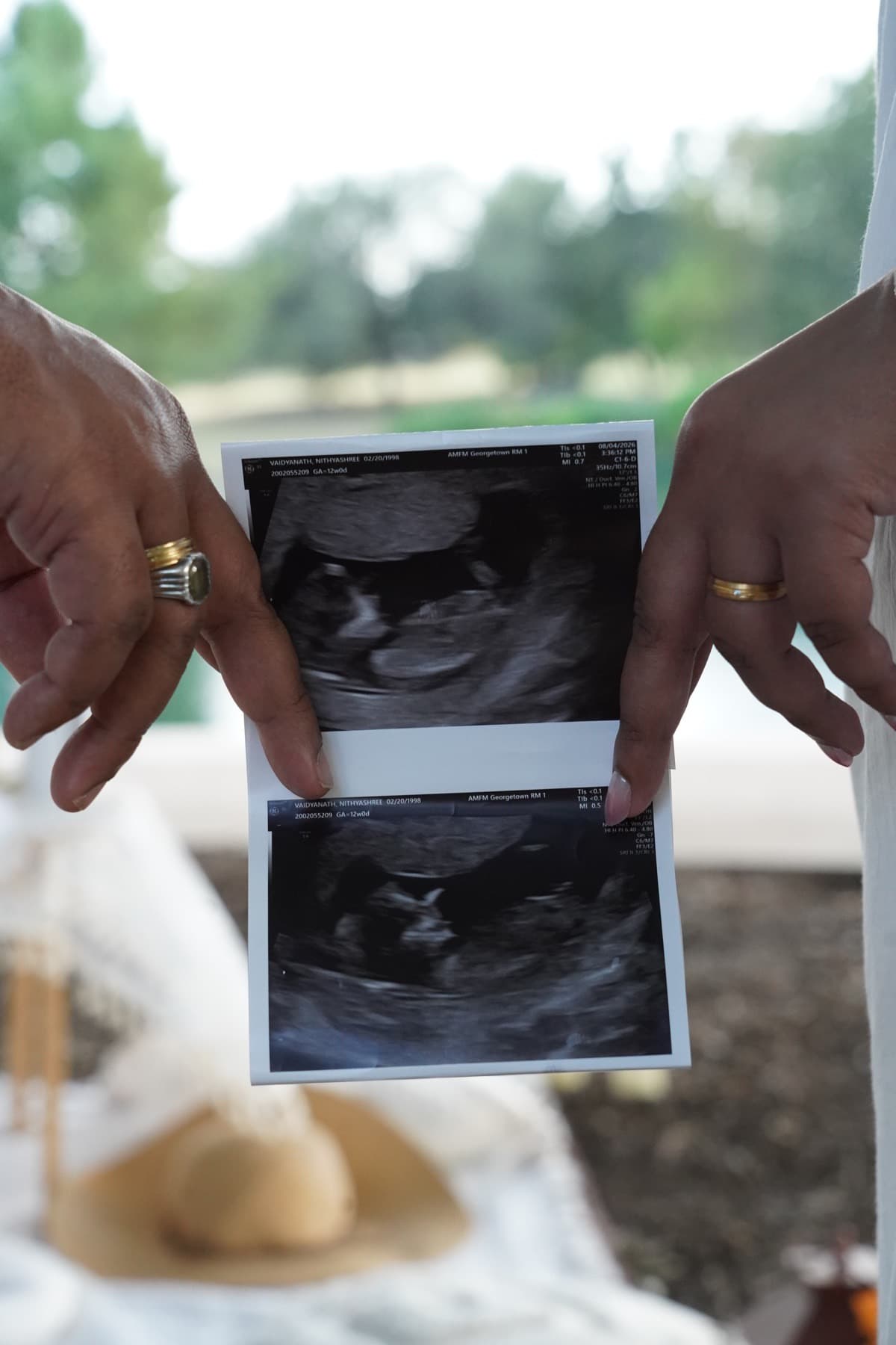 Couple holding ultrasound photos at a pregnancy announcement picnic in Austin